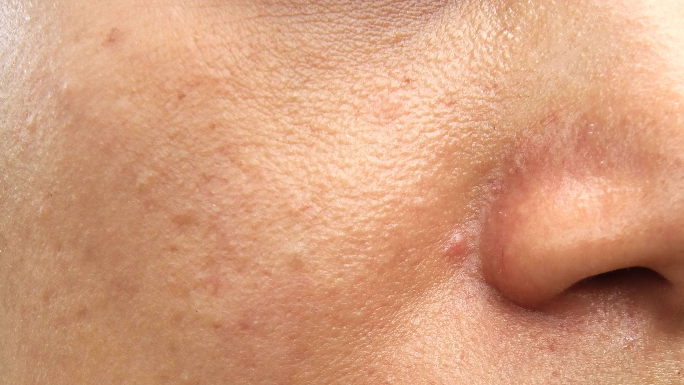 Face oils: the answer to oily skin.