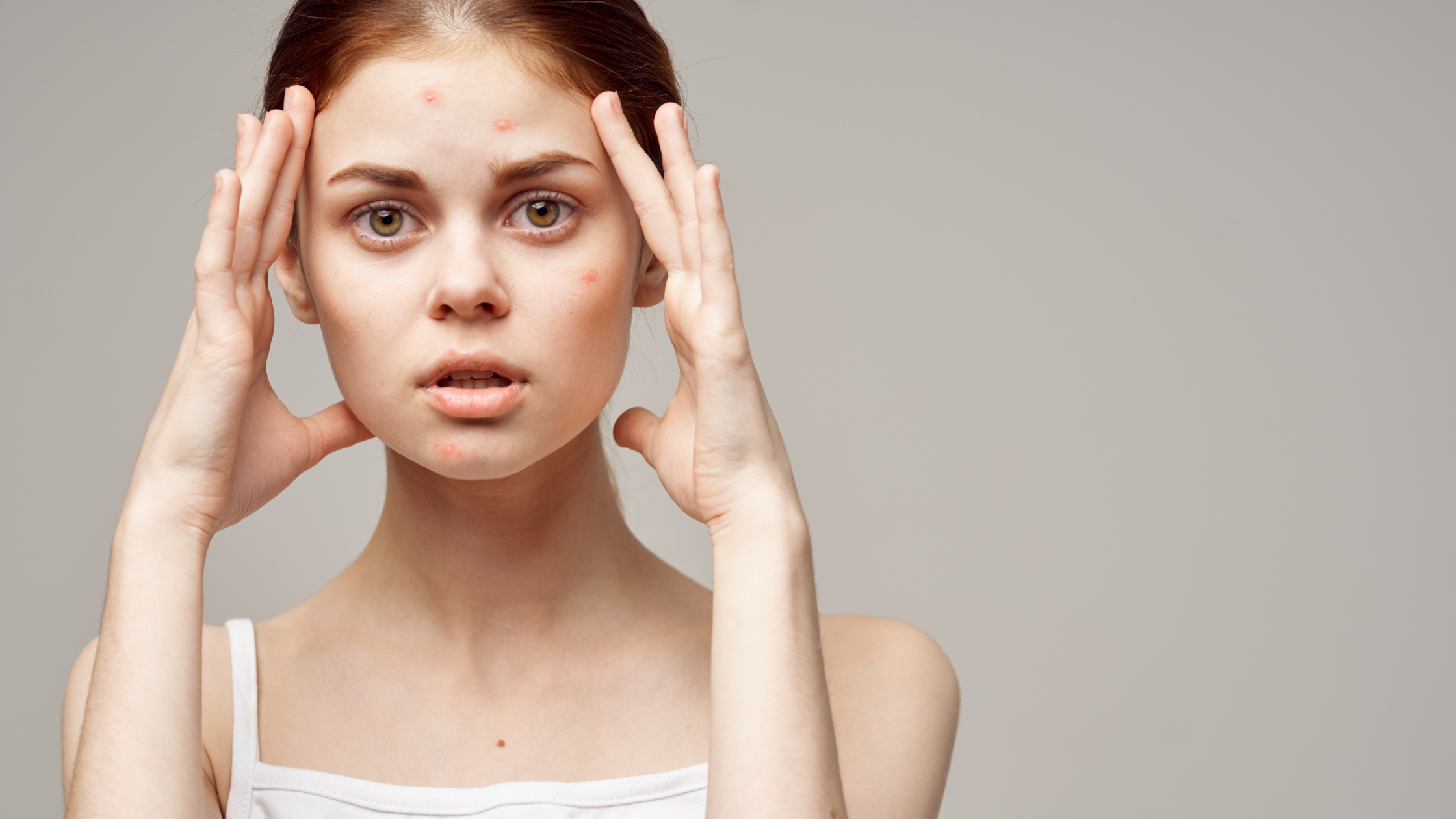 3 ways to help your skin if you're having a breakout