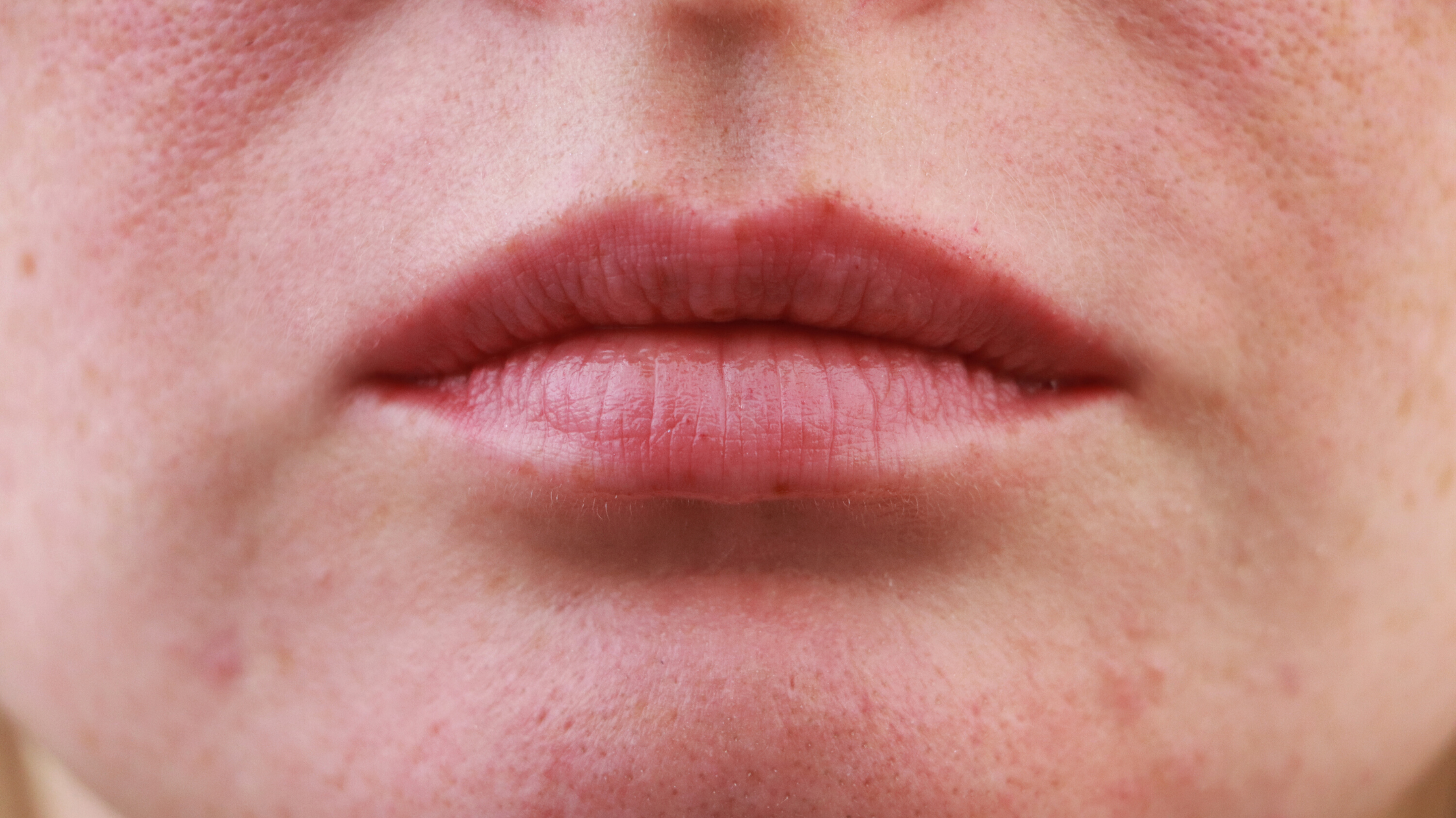 I have very large pores and I've tried everything. What do you recommend?