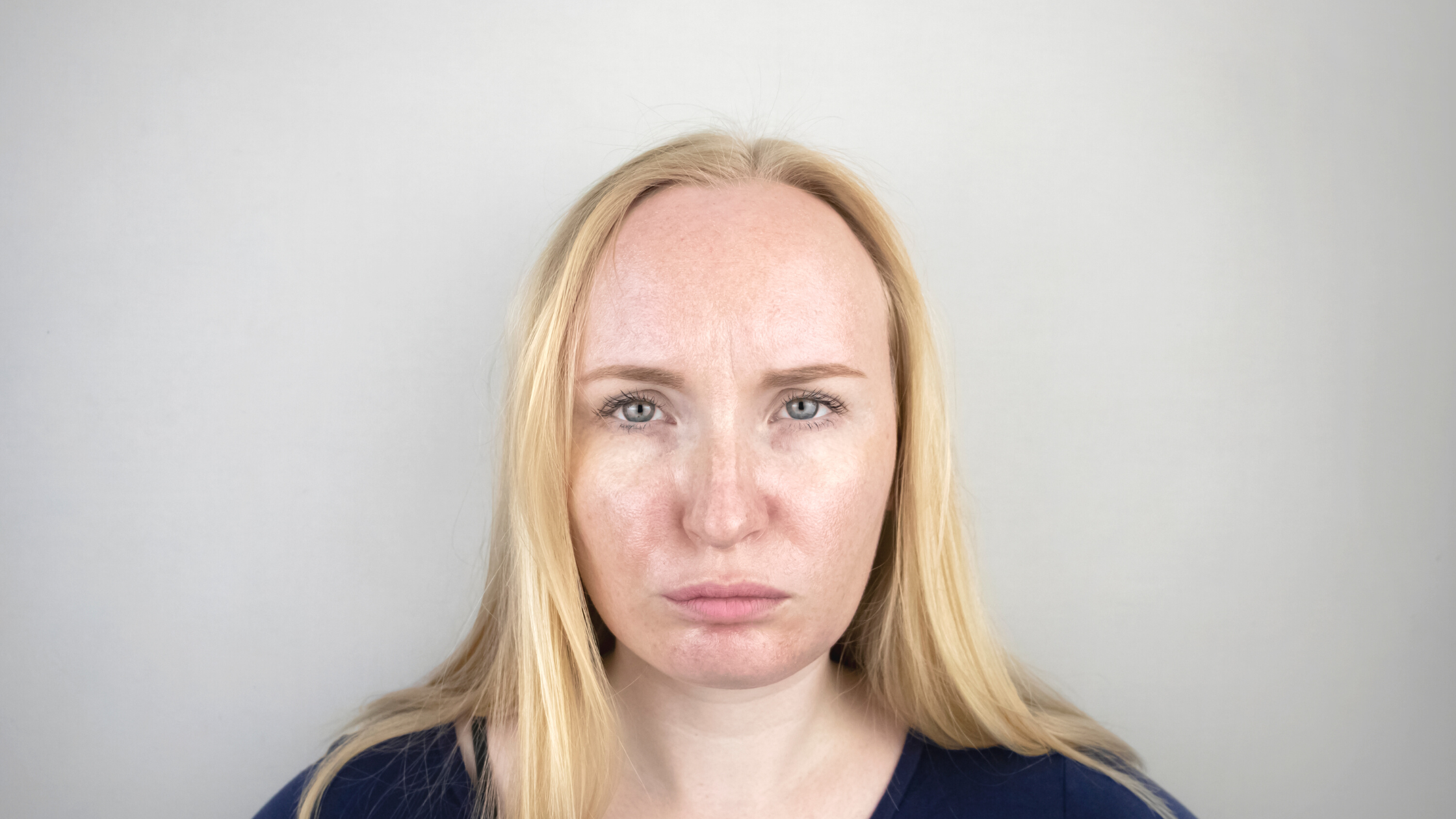 Why is my skin oily?