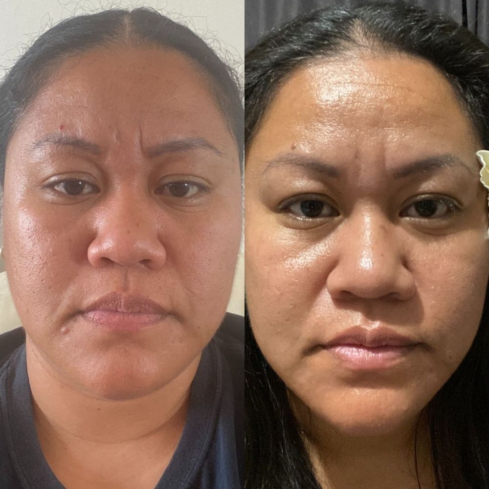 Before and after using LoveSkin Dry/Mature 3-Step Skincare Ritual showing glowing, hydrated skin.