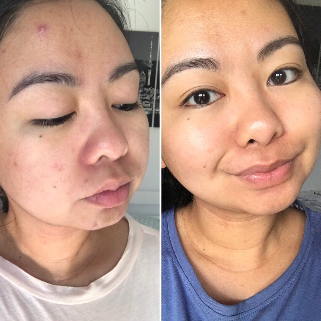 LOVESKIN Sensitive Skincare Ritual-SKINCARE RITUAL-LOVESKINNZ