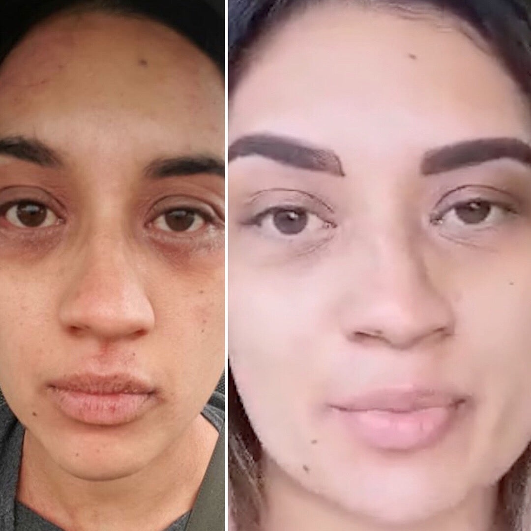 LOVESKIN Sensitive Skincare Ritual-SKINCARE RITUAL-LOVESKINNZ