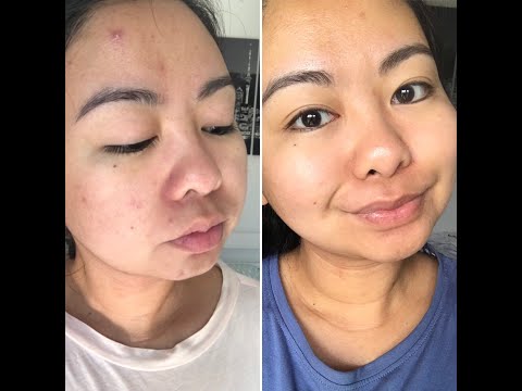 Video review using waiwai sensitive skin serum to nurture clear glowing skin