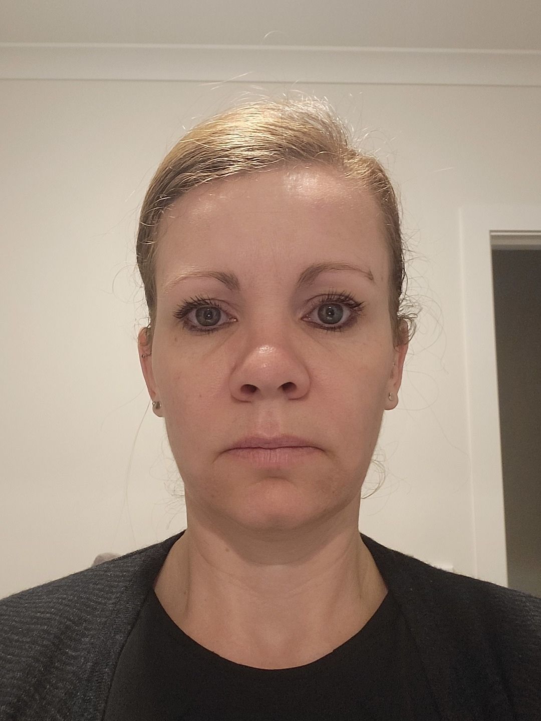 LoveSkin Customer Chantel showing her clear skin