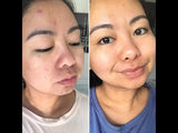 LOVESKIN Waiwai Facial Serum - Sensitive Skin